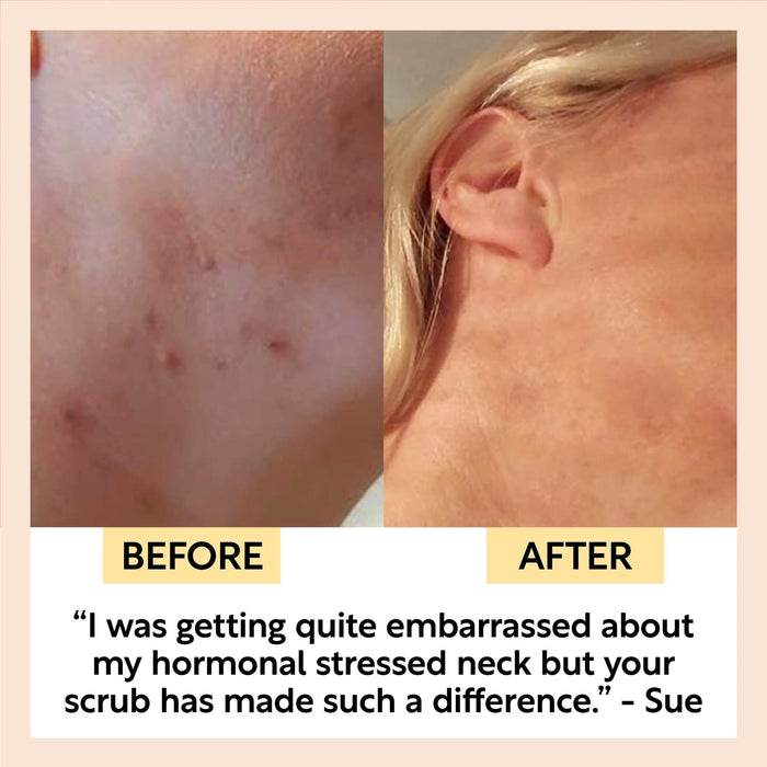 Natural Face Scrub – Citrus Blend for Dry Skin